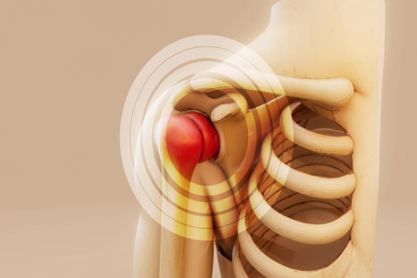 Dislocation Rehabilitation