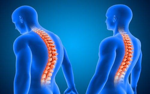 Spinal Deformity Management